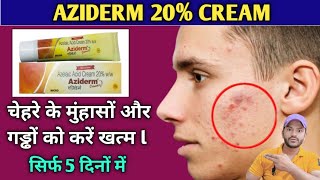 Aziderm 20 cream use dose benefits and side effects full review in hindi [upl. by Anelrad281]