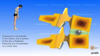 The intervertebral disc [upl. by Angid]