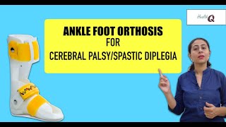 Things you should know about ANKLE FOOT ORTHOSIS [upl. by Nailuj]