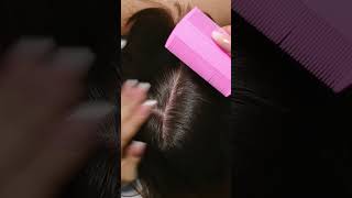 ASMR Relaxing LICE Check Removal and TREATMENT Real Person shorts short asmr [upl. by Arvell]