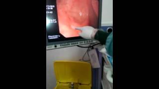 How to perform upper GI endoscopy [upl. by Janenna782]