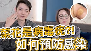 病毒疣會傳染怎麼辦？莊盈彥醫師跟蕭全佑醫師教大家如何治療及預防！ [upl. by Jacinto]