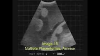 Ultrasound Pregnancy Testing 3rd Trimester Cows with ReproScan XTC [upl. by Mcnutt343]