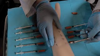 ASMR Hospital Allergy Testing  Intradermal Test Skin Exam [upl. by Verlie]