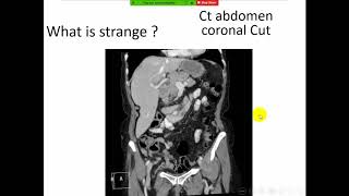 Radiological anatomy course frcr Abdomen 3  Arabic edition [upl. by Barhos]