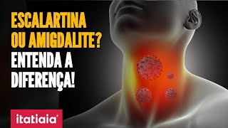 ESCOLAS FECHADAS POR BACTÉRIA ENTENDA O QUE É ESCARLATINA E A DIFERENÇA DA DOENÇA PARA AMIGDALITE [upl. by Ezar]