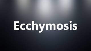 Ecchymosis  Medical Meaning and Pronunciation [upl. by Ttessil]