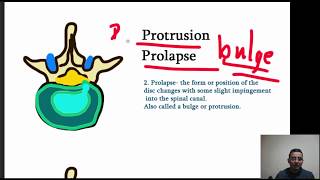 Intervertebral Disk Herniation prolapse  Four Stages of Herniation Made simple [upl. by Leaper]