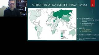 Diagnosis and Treatment of Tuberculosis a Case Study in Challenges and Threats Posed [upl. by Aldos480]