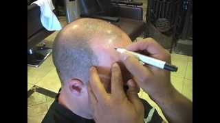 Micro Hair Pigmentation Demonstration  by Los Angeles Hair Tamir Melamed [upl. by Broeker]