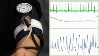 Oscillometric blood pressure measurement [upl. by Nordine]