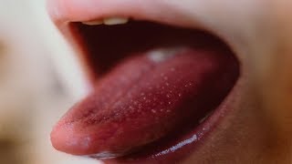 10 Common HIV Symptoms In Women That You Shouldnt Ignore [upl. by Amre]