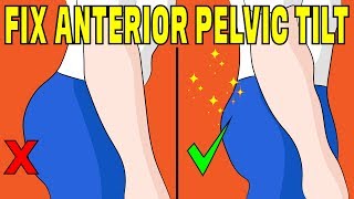 How to fix anterior pelvic tilt without any equipment  The Natural Method [upl. by Sorkin]