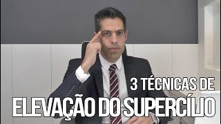 3 Técnicas de Elevação do Supercílio  Cirurgia Plástica Porto Alegre  André Valiati [upl. by Chobot755]