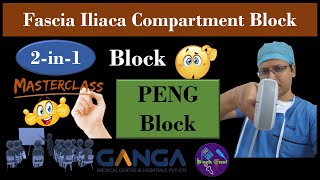 RA Masterclass Ultrasound Scanning Session  PENG Block  FICB  2in1 Block  DrTuhinM [upl. by Arv]