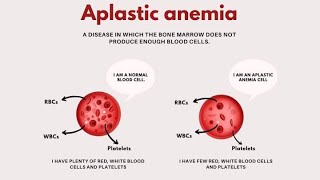 Aplastic Anaemia  Characteristics Causes Symptoms Diagnosis and Treatment [upl. by Kcirrem]