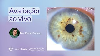 Aprenda a fazer uma análise de íris iridologia microsemioticairidea naturologia [upl. by Nauqel]