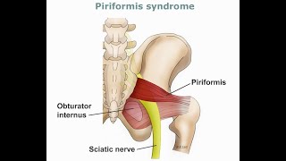 Sciatic Nerve Anatomy  Origin  Supply  Course  Divisions  Clinical Aspects [upl. by Liuka]