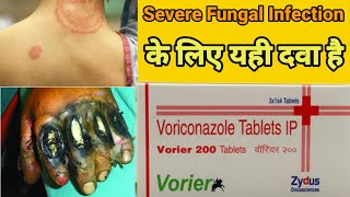 Voriconazole tablet  severe Fungal infections  Pharmachoice96 [upl. by Onaicram]