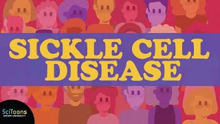 Sickle Cell Disease SCD A Neglected Global Health Burden [upl. by Allred]