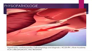 La cardiomyopathie hypertrophique CMH Partie 1 [upl. by Ahtaela]