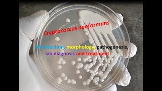 Cryptococcus neoformans Introduction morphology pathogenesis lab diagnosis and treatment [upl. by Chryste804]