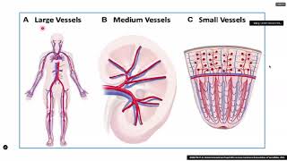 Vasculitis  Med Interna I [upl. by Ynots]