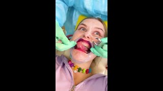 I Put Fake Veneers for Dentist 😂 prank [upl. by Harmony]