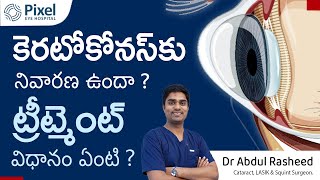 Keratoconus treatment in telugu  Keratoconus symptoms in telugu  Health video  Dr Abdul Rasheed [upl. by Eitten]