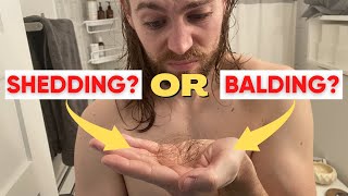 Are You Shedding Or Balding Telogen Effluvium Vs Male Pattern Baldness [upl. by Zoi]