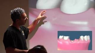 Dr Kevin Neshat  How Tooth Loss is Directly Related to Bone Loss [upl. by Agler880]