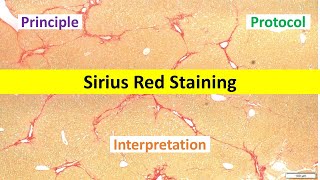 Sirius Red Staining Made Easy Beginners Overview  Principle Protocol amp Interpretation Tips [upl. by Notse]