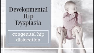 Developmental Hip Dysplasia  congenital hip dislocation [upl. by Nosauq]