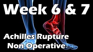 Achilles Rupture Update  Week 6 amp 7  Exercises Stretches Support Groups  Non Surgical [upl. by Oihsoy256]