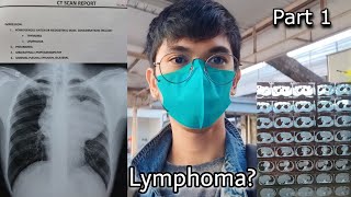 Part 1 Anterior Mediastinal Mass consider Lymphoma Pneumonia and Minimal Pleural Effusion [upl. by Ruthe86]