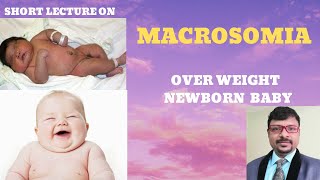 WHAT IS MACROSOMIA CAUSES OF OVER WEIGHT NEWBORN BABY FETAL MACROSOMIA [upl. by Redliw]