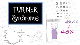 What is Turner Syndrome HealthSketch [upl. by Nois865]