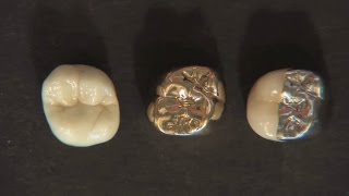 ¿Qué es BruxZir® Solid Zirconia [upl. by Beauchamp]