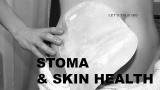 Stoma and Skin Health [upl. by Leoni]