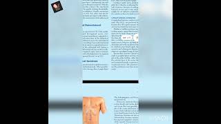 01 Fascia and fascial spaces of anterolateral abdomen wall  Neurovasculature of abdominal wall [upl. by Llekcm]