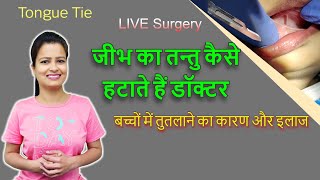 TongueTie release surgery  tutlana kaise sahi karen  tongue tie treatment in infants [upl. by Nywnorb]