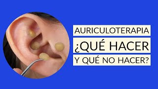 AURICULOTERAPIA aplicacion correcta puntos FUNCIONA 💖👍✨ [upl. by Suchta]