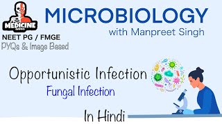 Microbiology 27  Opportunistic Fungal Infections Microbiologywith Manpreet Singh’s Medicine Addict [upl. by Welker]