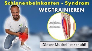 Shin Splints Schienenbeinkantensyndrom  Die 3 Besten Übungen  Ursache amp Lösung [upl. by Dzoba]