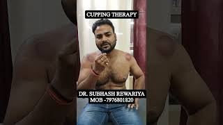 Cupping therapy gymmember improvehealth physiotherapist [upl. by Adeirf]