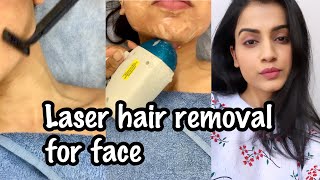 LASER HAIR REMOVAL FACE  My Experience of Facial Laser Hair Removal  Laser Hair Removal in India [upl. by Hamfurd]