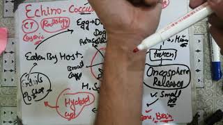 echinococcusgranulosus🌹🌹 echinococcus 2 life cycle parasitology microbiology levinson [upl. by Assilym]