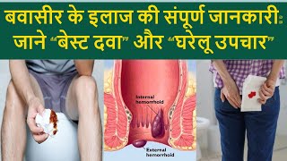 Bawaseer ka ilaj dawa II Bawasir ka gharelu ilaj in hindi II Bawasir me kya khaye I Piles treatment [upl. by Yarod627]