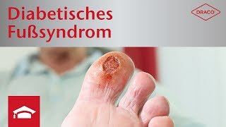 Diabetisches Fußsyndrom Diagnostik  Früherkennung Polyneuropathie  DRACO [upl. by Arst]