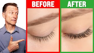 How to Grow Long Thick Eyelashes QUICKLY  Dr Berg [upl. by Bigot565]